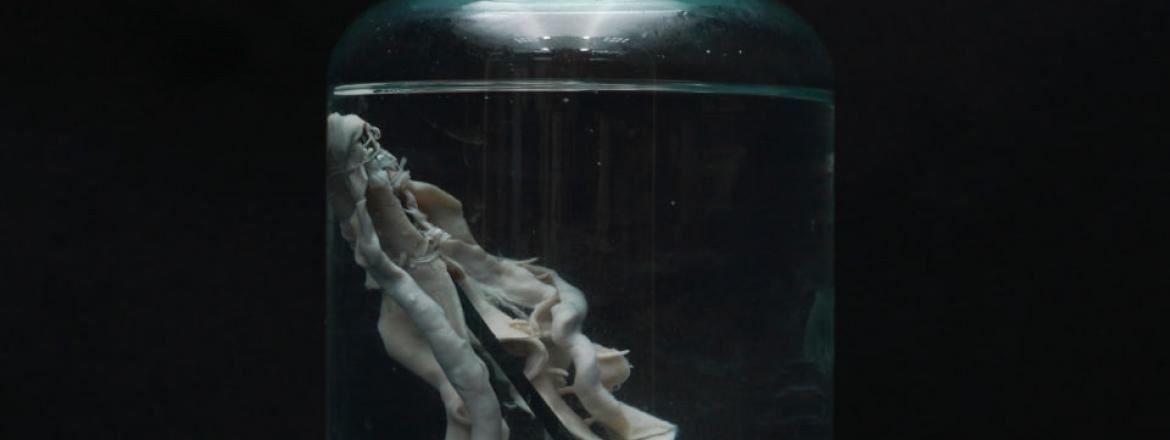 Выставка «Паразиты. Те, кто живут внутри»